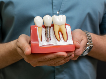 cabinetdentaireagdeimplant