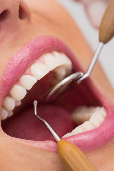 cabinetdentaireagdeparo2